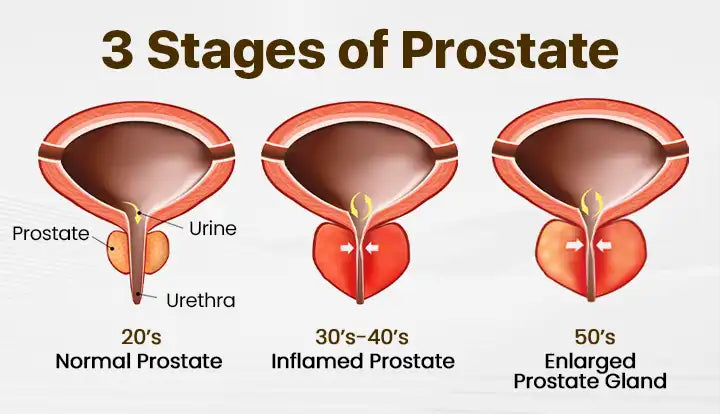 ProstaVibe Bee Wellness Inhaler