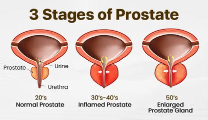 ProstaVibe Bee Wellness Inhaler