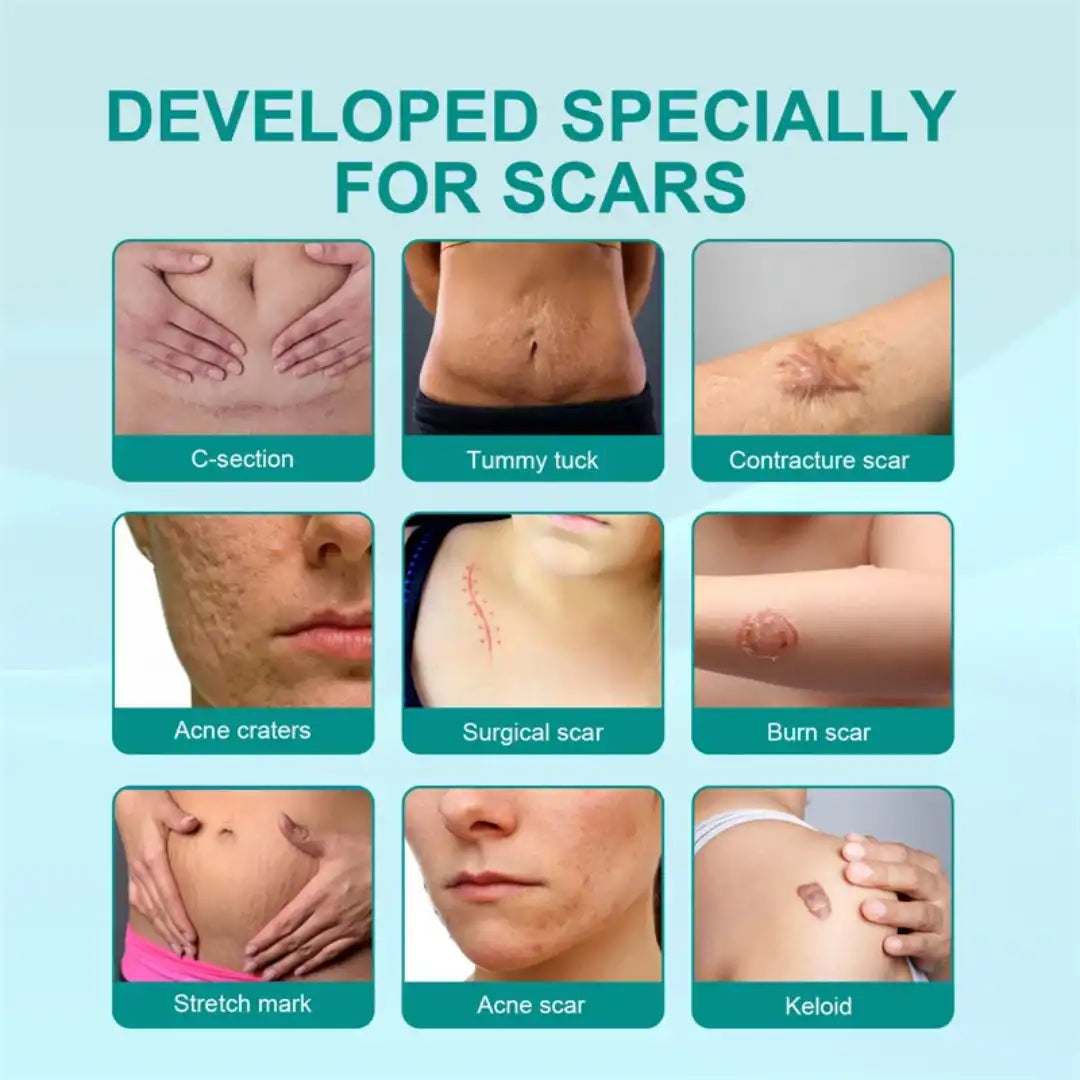 Medical grade scar spray