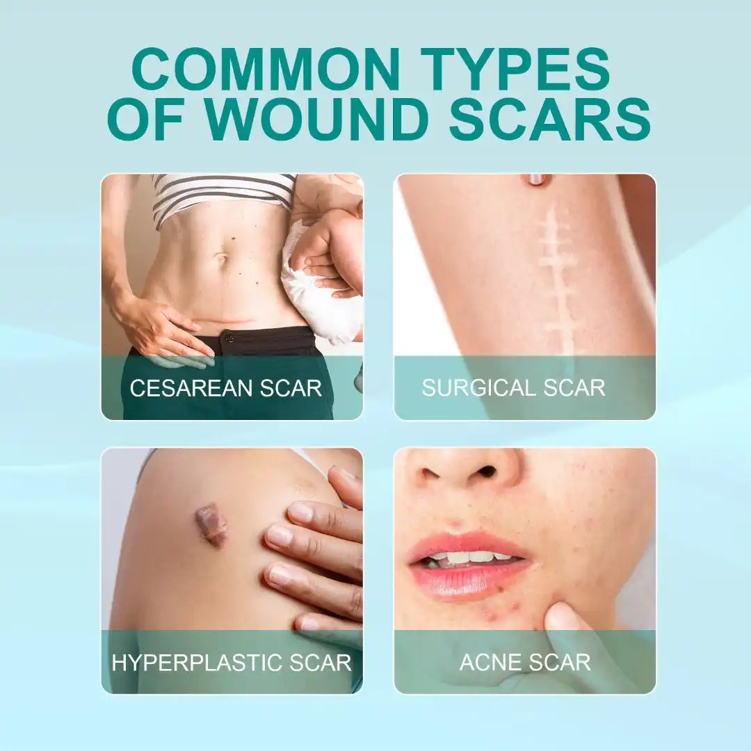 Medical grade scar spray